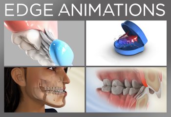 Edge Animations: Animated Patient Education