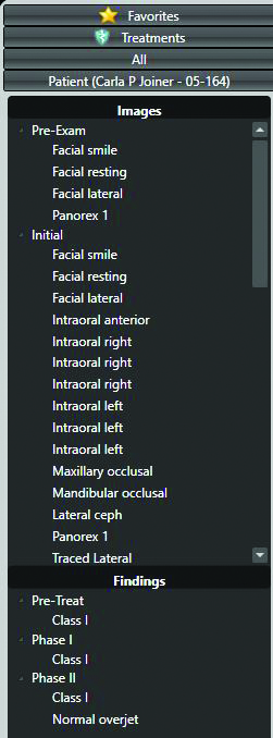 Using Treatment Findings With Edge Animations